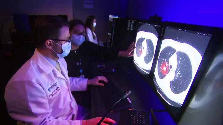 AI is Revolutionizing Breast Cancer Screening